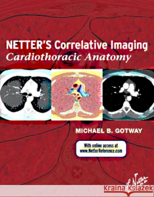 Netter's Correlative Imaging: Cardiothoracic Anatomy: With Online Access at Www.Netterreference.com Gotway, Michael B. 9781437704402 0