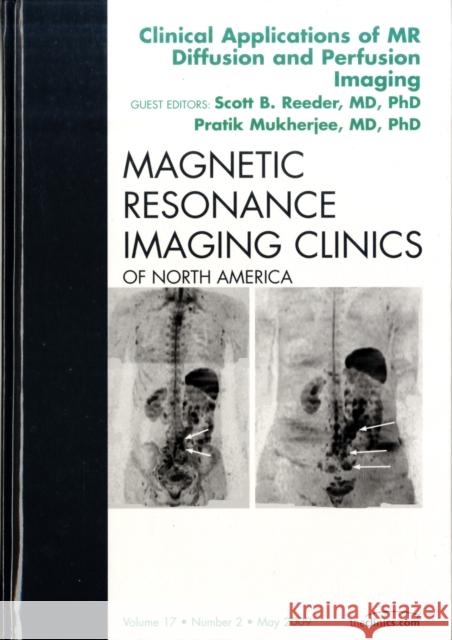 Clinical Applications of MR Diffusion and Perfusion Imaging, an Issue of Magnetic Resonance Imaging Clinics: Volume 17-2 Reeder, Scott B. 9781437704983 W.B. Saunders Company