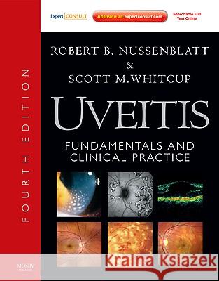 Uveitis : Fundamentals and Clinical Practice: Expert Consult - Online and Print Robert B. Nussenblatt Scott M. Whitcup 9781437706673 Mosby