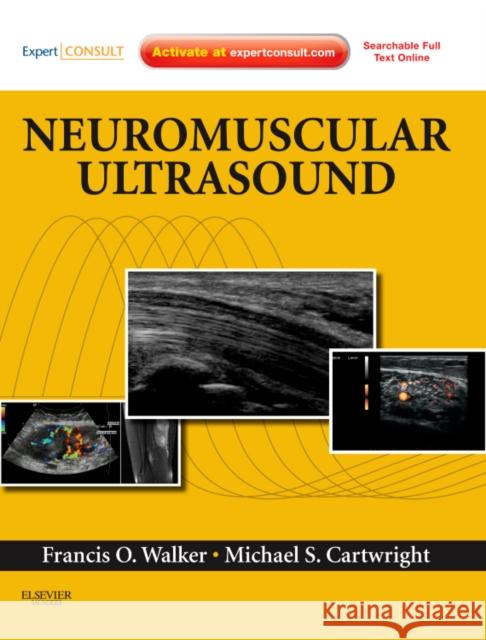 Neuromuscular Ultrasound: Expert Consult - Online and Print Michael S. (Assistant Professor of Neurology, Wake Forest University School of Medicine, Winston-Salem, NC) Cartwright 9781437715279