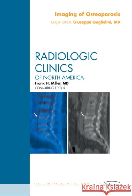 Imaging of Osteoporosis, an Issue of Radiologic Clinics of North America: Volume 48-3 Guglielmi, Giuseppe 9781437719444 W.B. Saunders Company