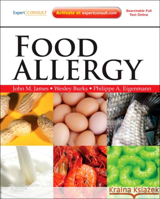 Food Allergy James, John M. 9781437719925