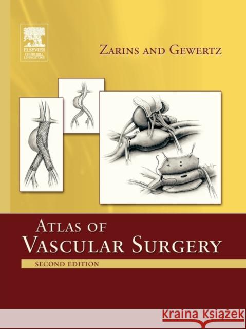 Atlas of Vascular Surgery - Paperback Edition Zarins, Christopher K. 9781437722253 Churchill Livingstone