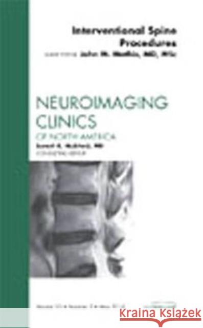 Image-Guided Spine Interventions, An Issue of Neuroimaging Clinics Mathis, John M. 9781437722710 Saunders