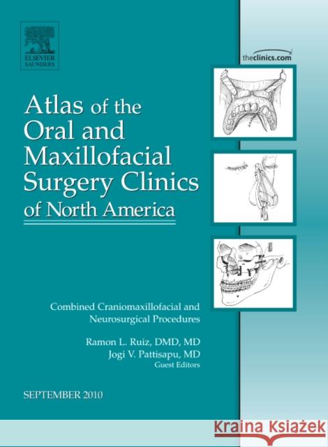 Combined Craniomaxillofacial and Neurosurgical Procedures, an Issue of Atlas of the Oral and Maxillofacial Surgery Clinics: Volume 18-2 Ruiz, Ramon L. 9781437724271 0