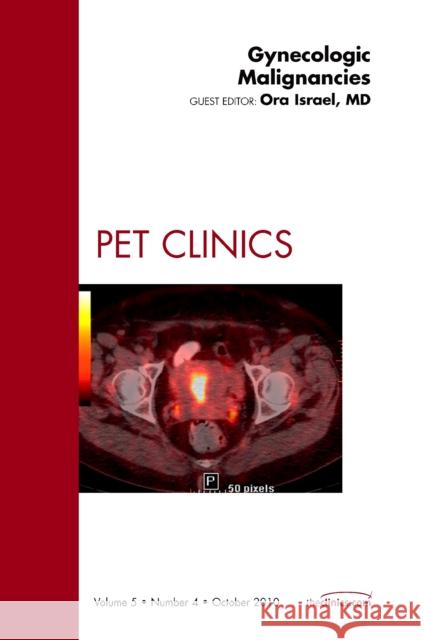 Gynecologic Malignancies, an Issue of Pet Clinics: Volume 5-4 Israel, Ora 9781437725933 Saunders