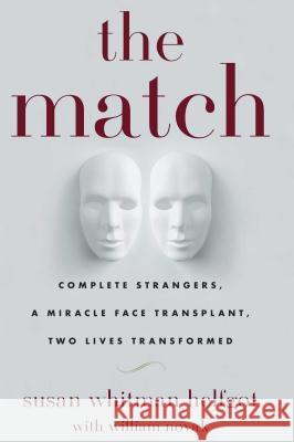 The Match: Complete Strangers, a Miracle Face Transplant, Two Lives Transformed Susan Whitma William Novak 9781439195499 Simon & Schuster