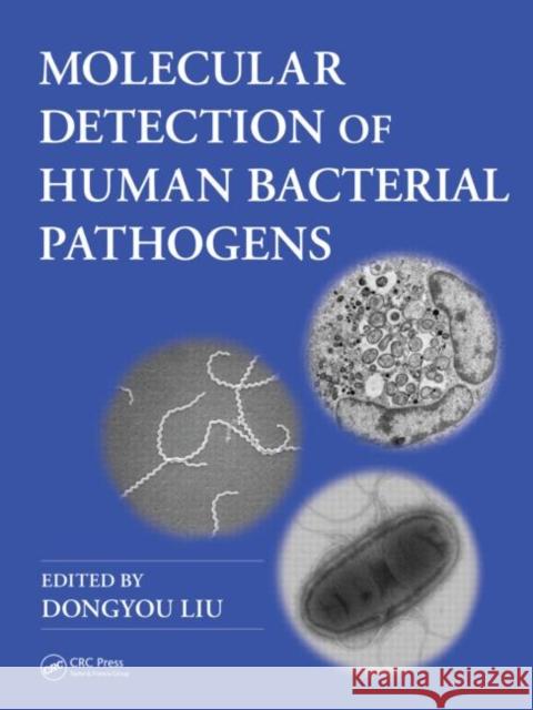 Molecular Detection of Human Bacterial Pathogens Dongyou Liu 9781439812389 0