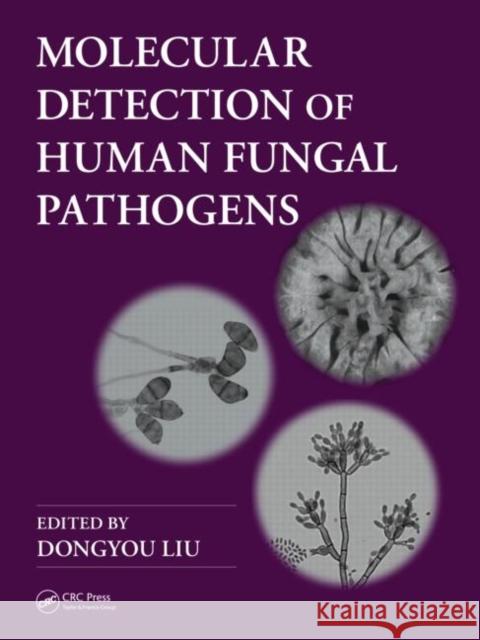 Molecular Detection of Human Fungal Pathogens   9781439812402 