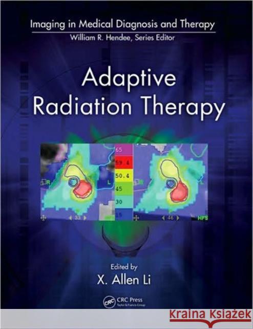 Adaptive Radiation Therapy X. Allen Li   9781439816349 Taylor & Francis