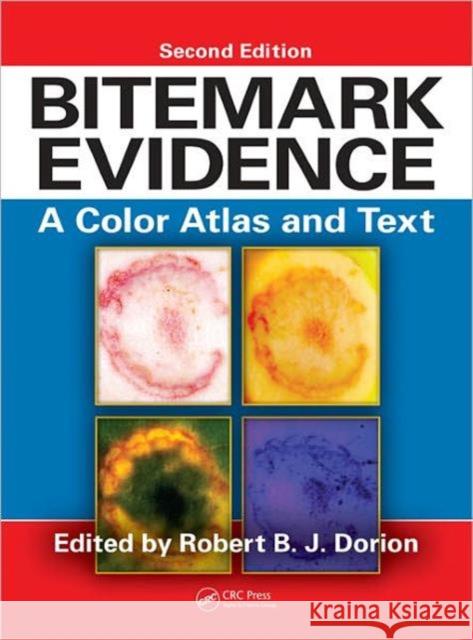 Bitemark Evidence: A Color Atlas and Text, 2nd Edition Dorion, Robert B. J. 9781439818626 CRC Press Inc