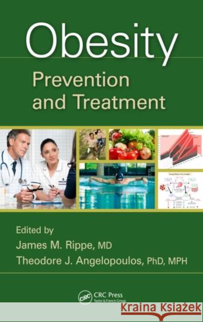 Obesity: Prevention and Treatment Rippe, James M. 9781439836712 CRC Press