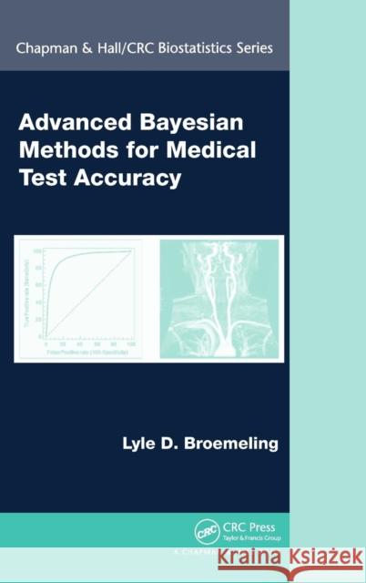 Advanced Bayesian Methods for Medical Test Accuracy Lyle D. Broemeling 9781439838785 CRC Press