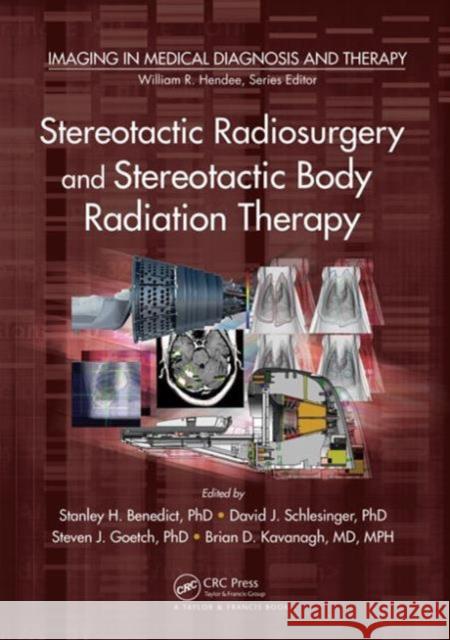 Stereotactic Radiosurgery and Stereotactic Body Radiation Therapy Stanley H. Benedict, Ph.D. David J. Schlesinger Steven J. Goetsch 9781439841976