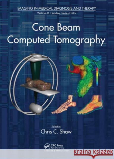 Cone Beam Computed Tomography Chris C. Shaw 9781439846261