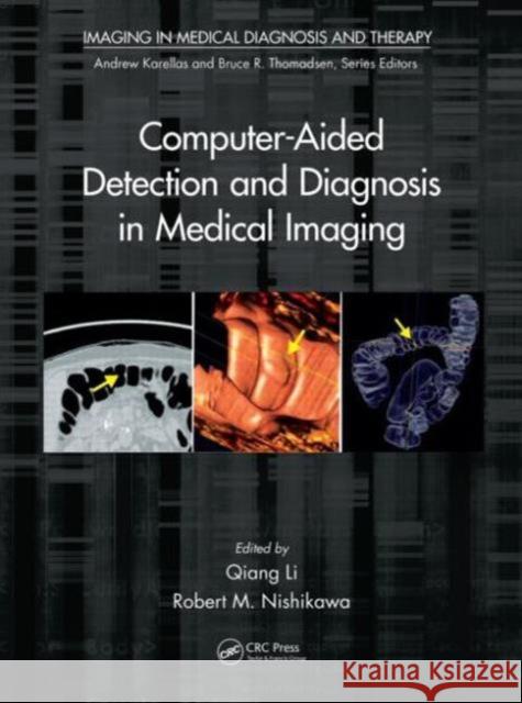 Computer-Aided Detection and Diagnosis in Medical Imaging Qiang Li Robert M. Nishikawa 9781439871768 CRC Press