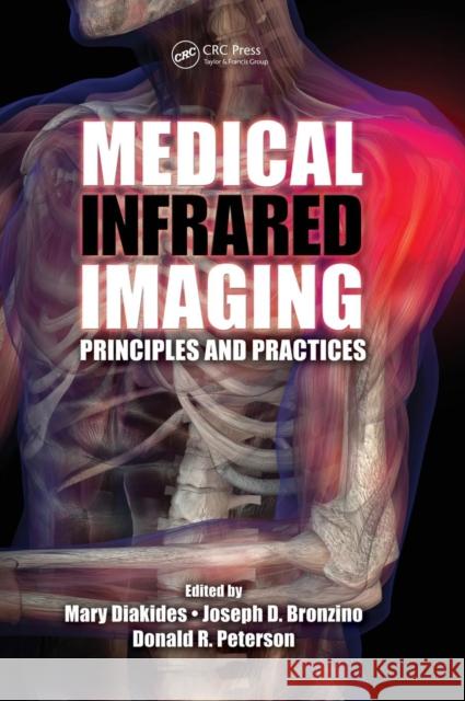 Medical Infrared Imaging: Principles and Practices Diakides, Mary 9781439872499 CRC Press