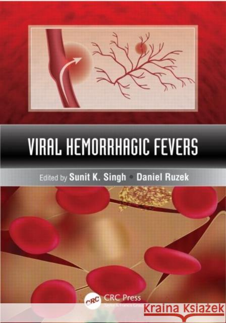 Viral Hemorrhagic Fevers Sunit K. Singh Daniel Ruzek 9781439884294