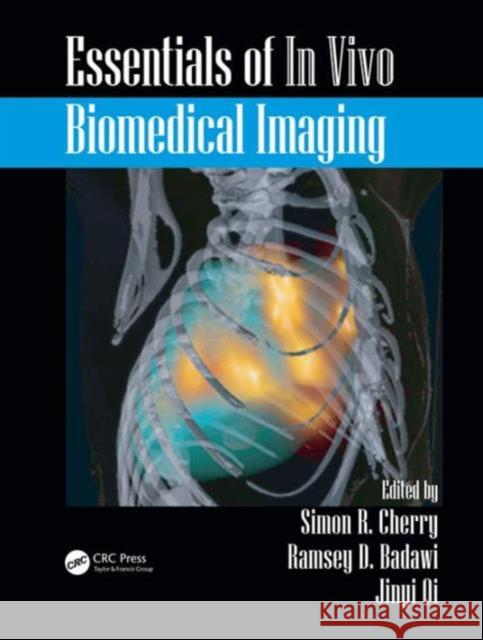 Essentials of in Vivo Biomedical Imaging Simon R. Cherry Ramsey D. Badawi Jinyi Qi 9781439898741