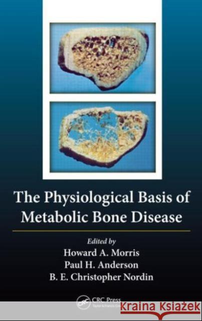 The Physiological Basis of Metabolic Bone Disease Borje Edgar Christopher Nordin Borje Edgar Christopher Nordin Howard Arthur Morris 9781439899427