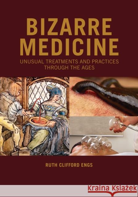 Bizarre Medicine: Unusual Treatments and Practices through the Ages Engs, Ruth Clifford 9781440871245 Greenwood