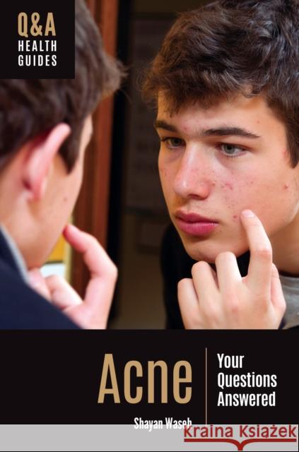 Acne: Your Questions Answered Shayan Waseh 9781440879685 Greenwood