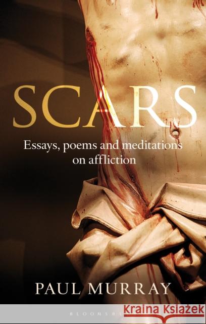 Scars: Essays, Poems and Meditations on Affliction Dr Paul Murray OP (Angelicum University, Italy) 9781441175632