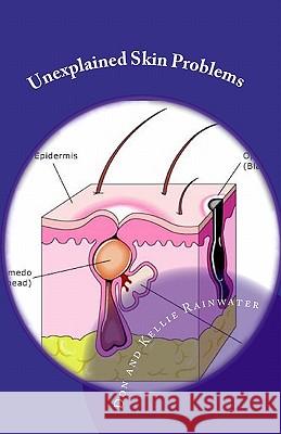Unexplained Skin Problems: Home Treatment And Precautions Rainwater, Don 9781441443625 Createspace
