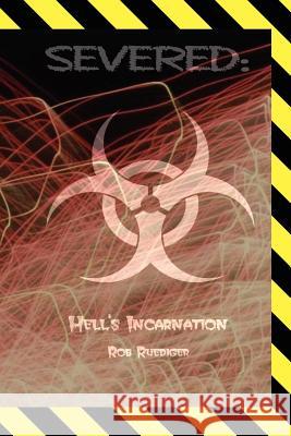 Severed Rob Ruediger 9781441516718 Xlibris Corporation