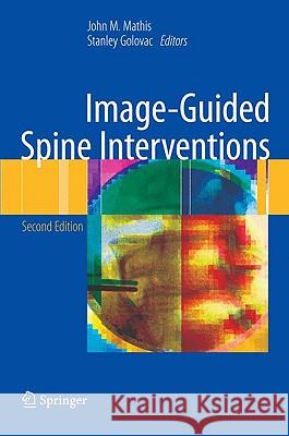 Image-Guided Spine Interventions Mathis 9781441903518