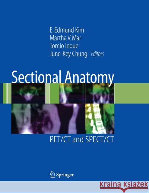 Sectional Anatomy: PET/CT and SPECT/CT Kim, E. Edmund 9781441915894 Springer