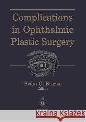 Complications in Ophthalmic Plastic Surgery Brian G. Brazzo 9781441918130