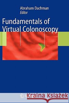 Fundamentals of Virtual Colonoscopy Abraham H. Dachman 9781441919526 Not Avail