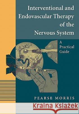 Interventional and Endovascular Therapy of the Nervous System: A Practical Guide Morris, Pearse 9781441929037 Not Avail