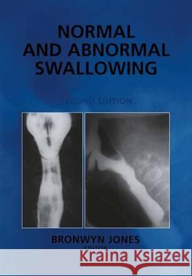 Normal and Abnormal Swallowing: Imaging in Diagnosis and Therapy Jones, Bronwyn 9781441929044 Not Avail