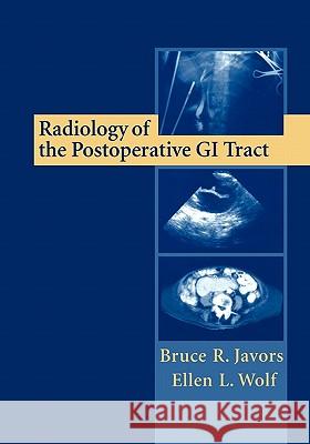 Radiology of the Postoperative GI Tract Bruce R. Javors Ellen L. Wolf 9781441929068 Not Avail