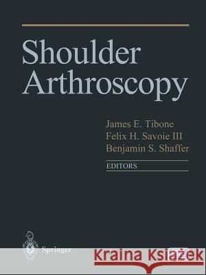 Shoulder Arthroscopy James Tibone Felix H. III Savoie Benjamin Shaffer 9781441929723 Not Avail
