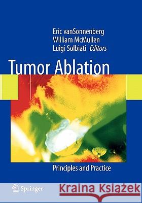 Tumor Ablation: Principles and Practice Van Sonnenberg, Eric 9781441930460 Not Avail