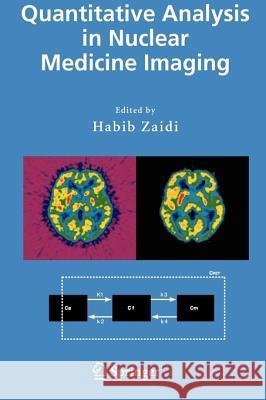 Quantitative Analysis in Nuclear Medicine Imaging Habib Zaidi 9781441936684 Not Avail
