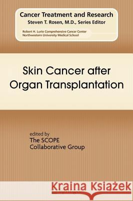Skin Cancer After Organ Transplantation Stockfleth, Eggert 9781441946164 Springer