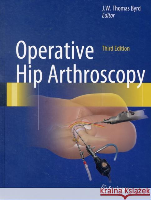 Operative Hip Arthroscopy J W Thomas Byrd 9781441979247 0