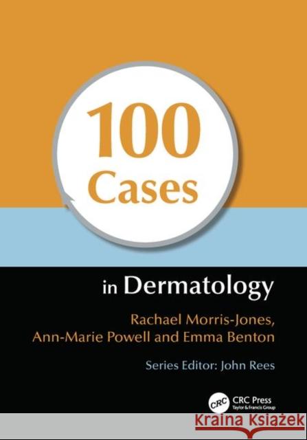 100 Cases in Dermatology Rachael Morris-Jones 9781444117936