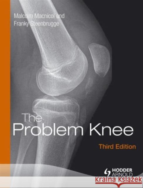 The Problem Knee Malcolm Macnicol 9781444120110