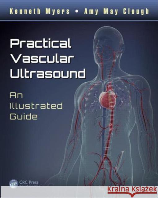Practical Vascular Ultrasound: An Illustrated Guide Myers, Kenneth 9781444181180 CRC Press
