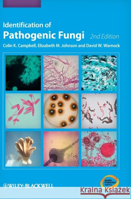 Identification of Pathogenic Fungi Colin Campbell 9781444330700 0