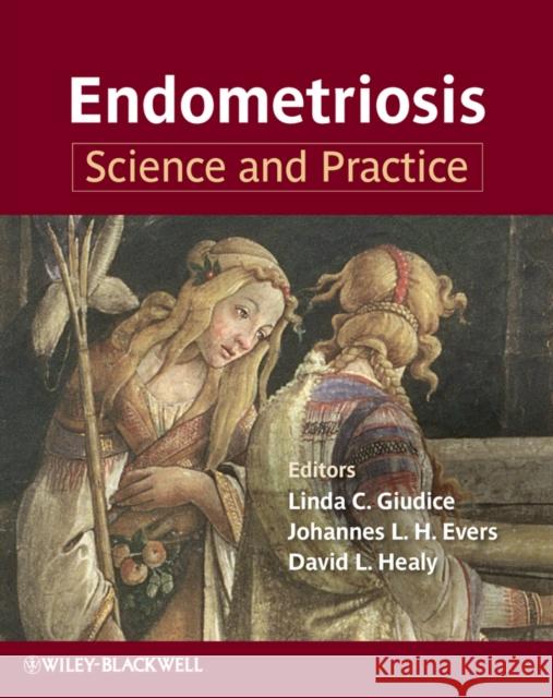 Endometriosis: Science and Practice Giudice, Linda C. 9781444332131