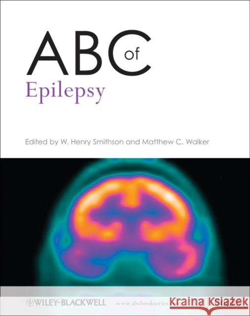 ABC of Epilepsy W Henry Smithson 9781444333985 0