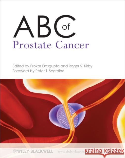 ABC of Prostate Cancer Prokar Dasgupta 9781444334371