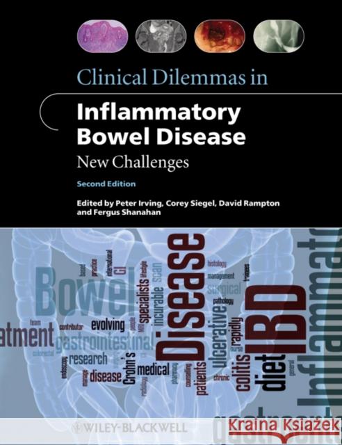 Clinical Dilemmas in Inflammatory Bowel Disease Irving, Peter 9781444334548 Wiley-Blackwell