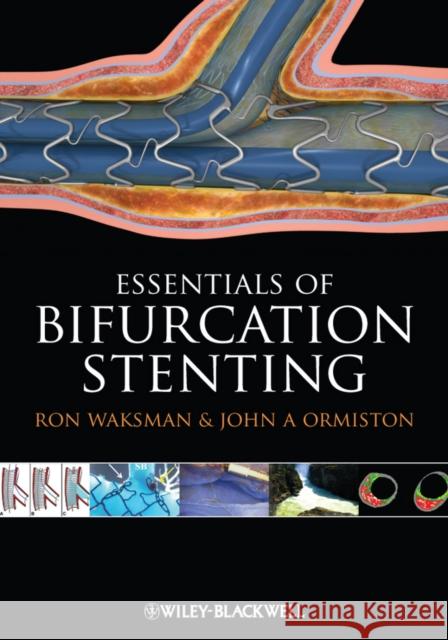 Bifurcation Stenting Ron Waksman John Ormiston 9781444334623